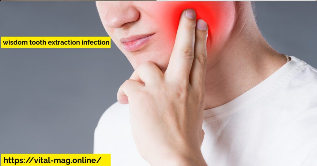 wisdom tooth extraction infection