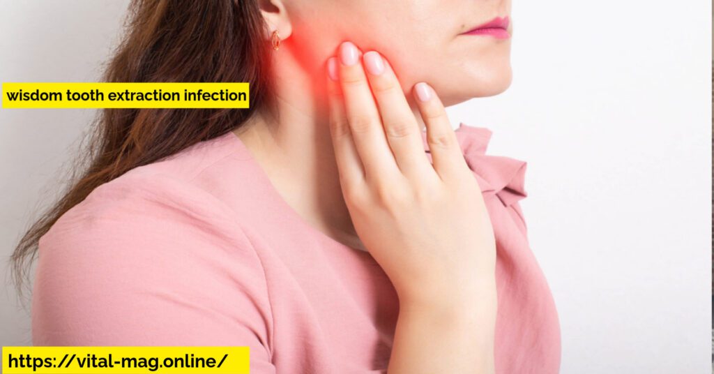 wisdom tooth extraction infection