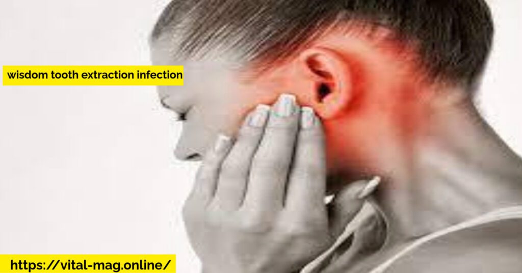 wisdom tooth extraction infection