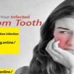 wisdom tooth extraction infection