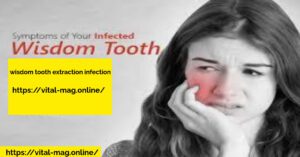 wisdom tooth extraction infection